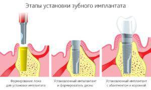 shutterstock_88850245_1300